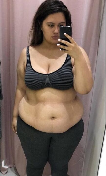 Jeg hatet kroppen min på grunn av de ekstra kiloene.